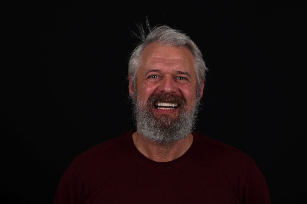 After full implant restoration — full smile restored.